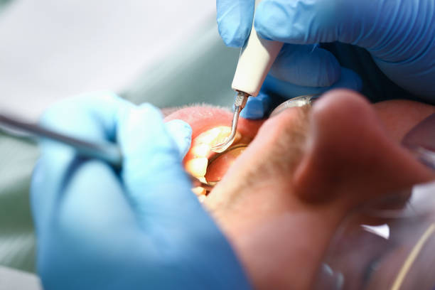 Best Walk-In Emergency Dentist in Peebles, OH